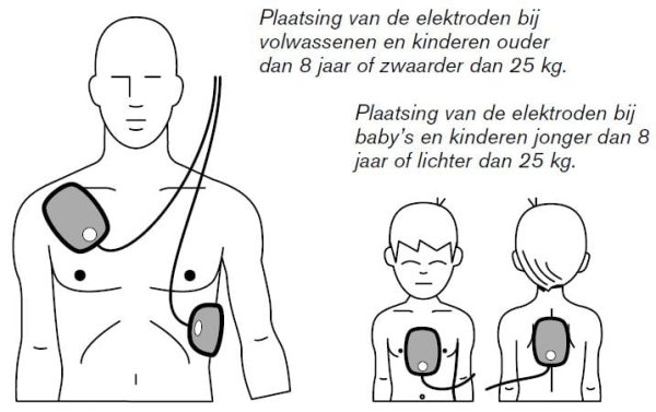 Philips HeartStart HS1 kinderelektroden - Afbeelding 2